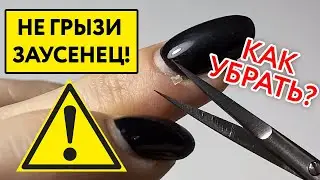 Home Manicure Mistakes: Hangnail on Finger and Side Nail Rollers