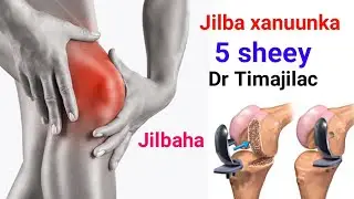 Jilba xanuunka iyo roomatiisamka 2 sheey bas aaa u....