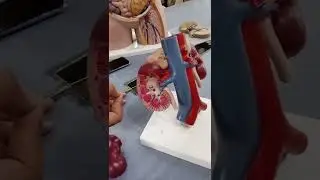 kidneys model | abdominal aorta and inferior vena cava | blood supply of kidneys @jjmedicose7601