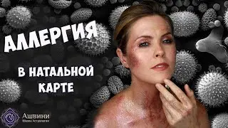 Медицинская Астрология - Аллергия в Натальной карте - Астролог Татьяна Калинина