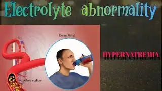 ELECTROLYTES  ABNORMALITY #HYPERNATREMIA #MADE_EASY