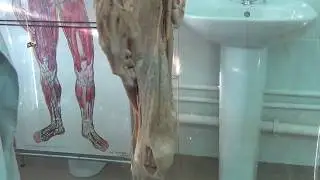 Артерии нижней конечности на трупе, подготовка к экзамену для студентов медиков