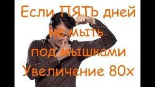 Если ПЯТЬ дней не мыть под мышками | Macro | Увеличение 80х