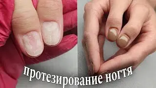 Протезирование ногтя 👌🏻 часть 2😉#маникюр #красивыйманикюр #ногти