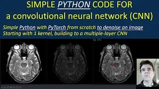 Simple code for convolution and a CNN to denoise an image with real-time display in Python / PyTorch