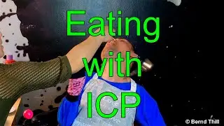 Chewing and Swallowing Challenges: Eating with Infantile Cerebral Palsy - My Personal Experience