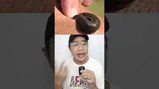 CARA SELAMAT DARI LINTAH!