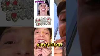 Peso Pluma PRESUME SU LUJOSA Y EXTRAVAGANTE prótesis de dientes con diamantes de más 50 Mil Dólares
