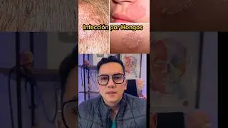 Fungal Skin Infections | Dr. William Guerrero 