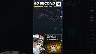 NIO looking bullish on technicals!
