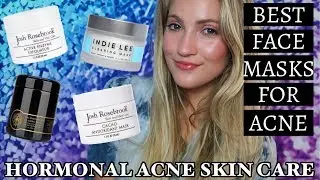 HORMONAL ACNE SKIN CARE // TOP NATURAL & ORGANIC FACE MASKS TO TREAT ACNE