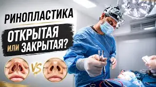 Ринопластика: Открытая / Закрытая. Алгоритм выбора