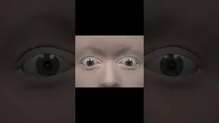 आँख की पुतली का झटका खाना - nystagmus