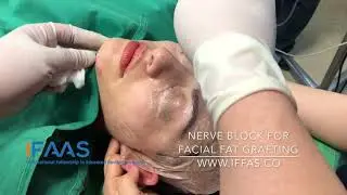 IFAAS Exclusive Video - Nerve Block: Local Anaesthesia for Facial Fat Grafting