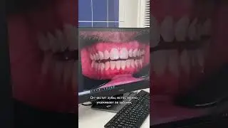Кровь из десны — это НЕ норма!
