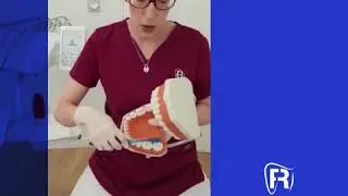 Técnica de barrido