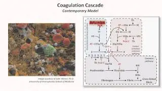 Hemostasis: Lesson 3 - Coagulation Cascade and Fibrinolysis