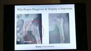 Approach to bone tumors