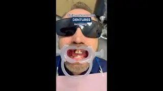 Watch AJ Get His Smile Back With This Incredible Denture Transformation