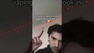 This changed my perspective forever… 😪💔