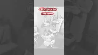 Пол Александр более 70 лет живет в аппарате «железное легкое» #fakebody #fakesituation #truestory