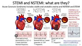 Acute coronary syndrome for exercise professionals