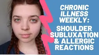 Chronic Illness Weekly Vlog: Shoulder Subluxation & Allergic Reactions