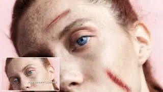 Wound Compositing