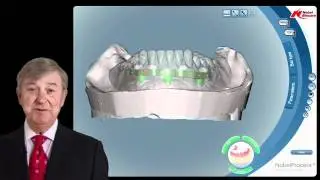 157-00 Procera CAD/CAM Technology with Bar Overdentures and Fixed Implant Restorations PREVIEW