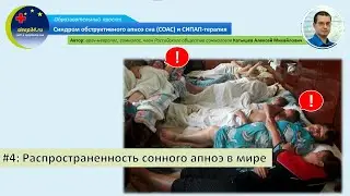 #4: Распространенность сонного апноэ в мире | СОАС и СИПАП-терапия