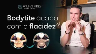 Tudo Que Você Precisa Saber Sobre o Bodytite | Dr. Wilian Pires