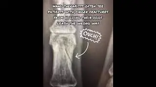Hand injuries from a dogs leash