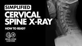 How to Read a Cervical X ray? Normal Anatomy - Simplified Systematic Approach