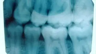 How to Lodge a Complaint about a Dentist