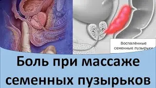Боль при массаже семенных пузырьков