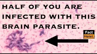 TOXOPLASMOSIS : MIND CONTROLLING BRAIN PARASITE !