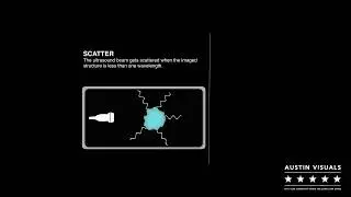 Ultrasound Animation Video | Austin Visuals