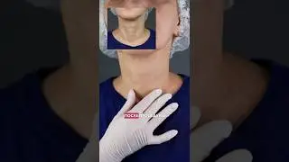 Омоложение шеи