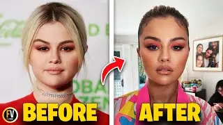 Selena Gomez Just Had Plastic Surgery? | Flixverse