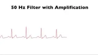 ECG 50 Hz Filter Demo 2