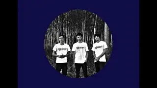 Rat Bite Fever - The di Boston