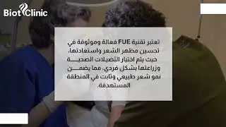 تعرف على تقنية FUE لزراعة الشعر مع  بايوت كلينك | Biot Clinic