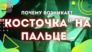 Как убрать "косточку" на большом пальце ? Часть 1