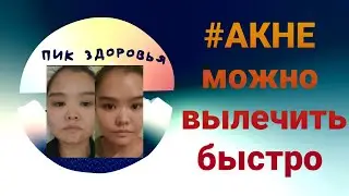 Акне. Можно вылечить быстро. Атоми/Atomy Акне эксперт контроль для проблемной кожи #акне#атоми