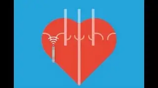 Abnormal Heart Rhythms (Arrhythmia)