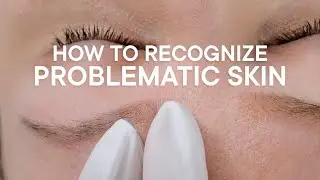How To Recognize Problematic Skin