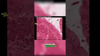 Exploring Simple Columnar Epithelium 