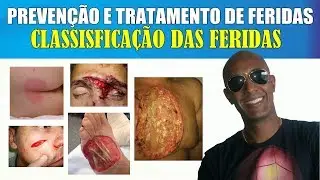 TRATAMENTO E PREVENÇÃO DE FERIDAS - CLASSIFICAÇÃO DAS LESÕES