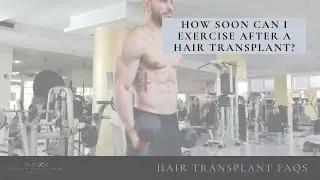 How soon can I exercise after a hair transplant?