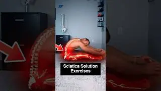 3-Step Sciatica Solution!